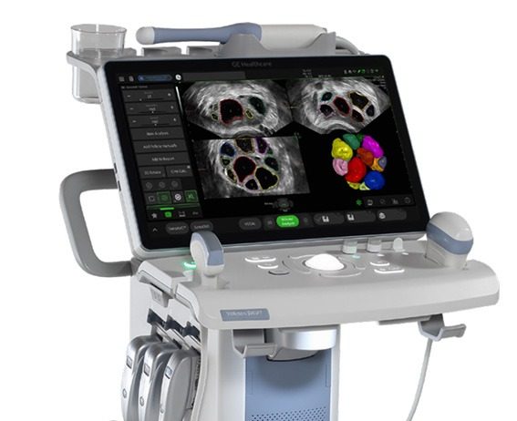 Our Angels Scanner Appeal - GE Voluson Swift